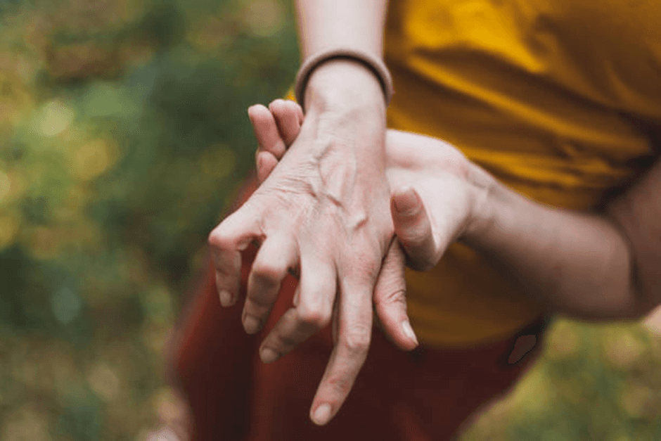 Close-up of hands showing signs of arthritis pain with the question can you ever stop the pain of Arthritis?
